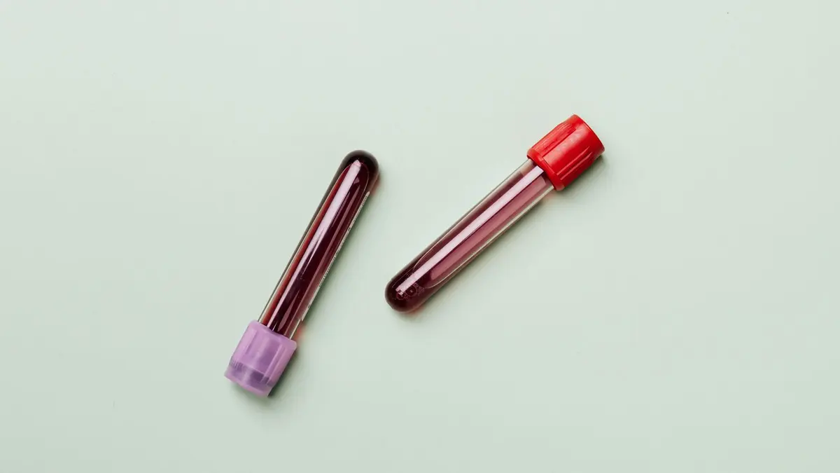 Two blood sample tubes with purple and red caps on a pale green background