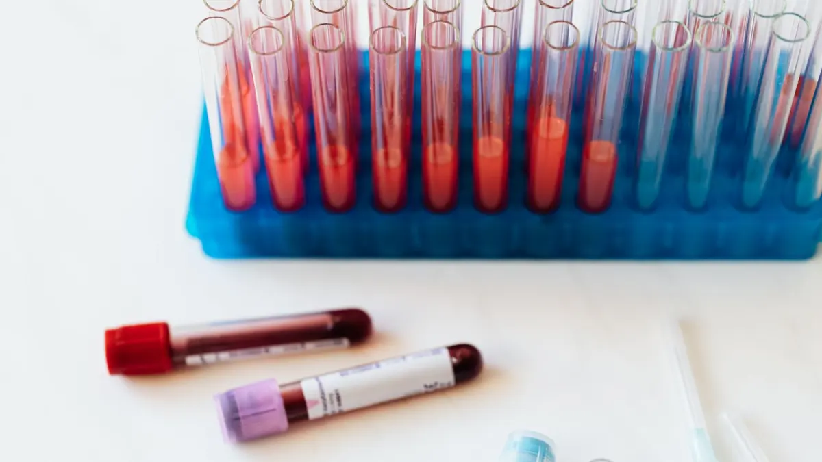 Rack of blood sample tubes and vials on a lab counter, representing a routine blood draw like a PSA test